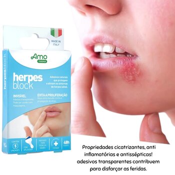 Herpes block adesivos naturais para herpes labial 5un - Amoveri Farma